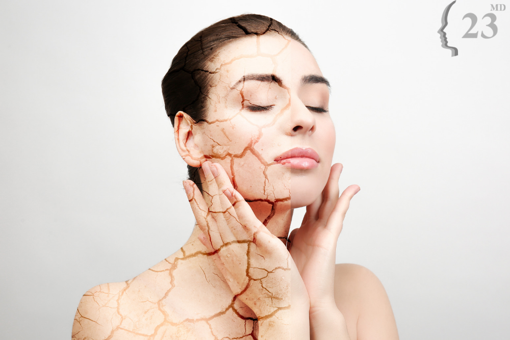 5 ways to improve skin dryness
