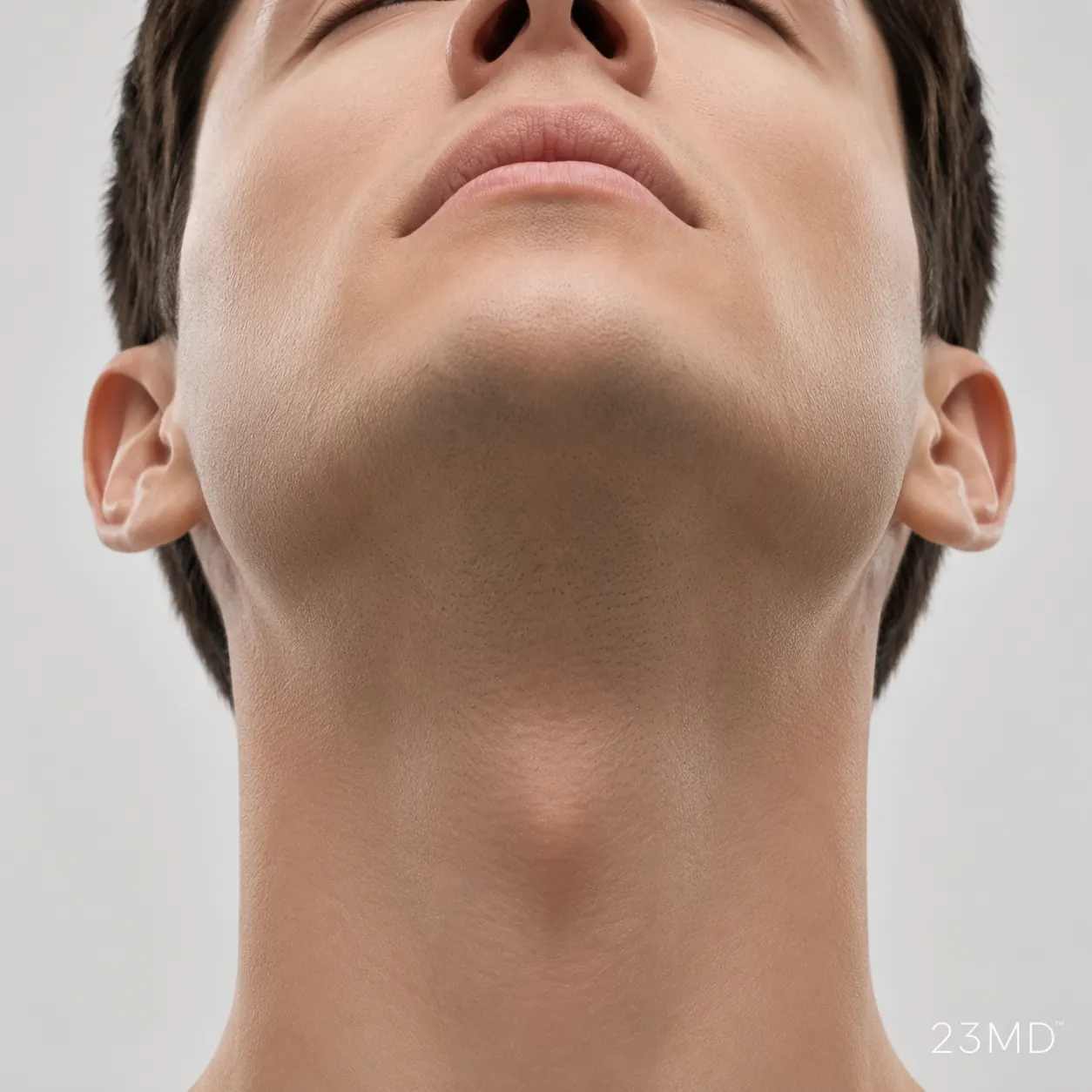 Close-up of a patient's chin and neck illustrating an area considered for dermal filler treatment at 23MD