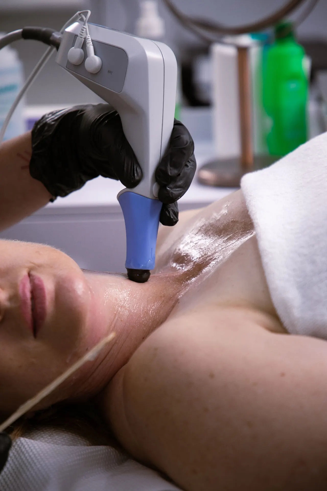 A radiofrequency applicator being applied to a patient's jawline at 23MD