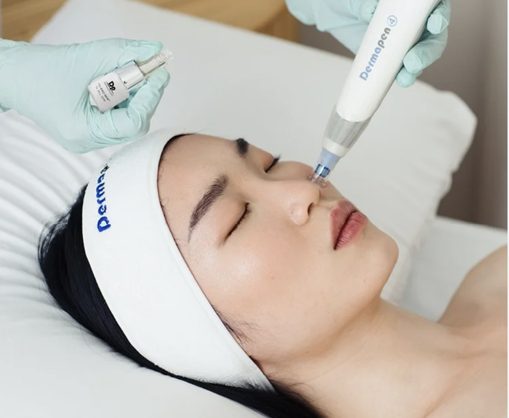 ExoFusion: 23MD’s Exosome Skin Protocol