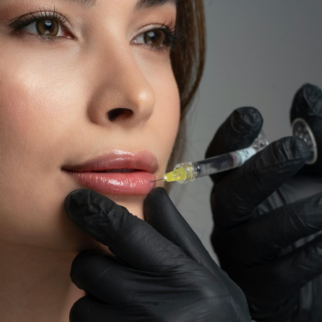 Lip Enhancement