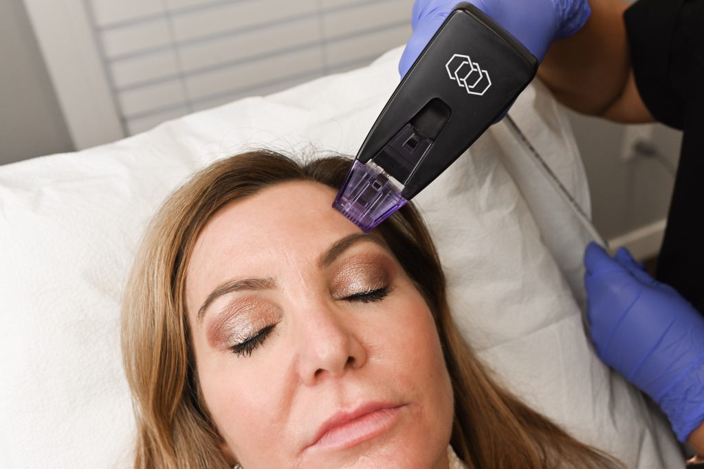 Morpheus8 vs. HIFU: Which is right for you?