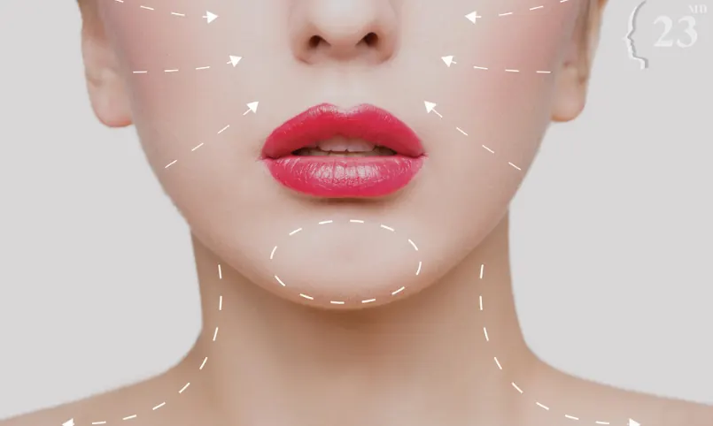 Lips and lower face marked with dotted lines illustrating an archived health article at 23MD