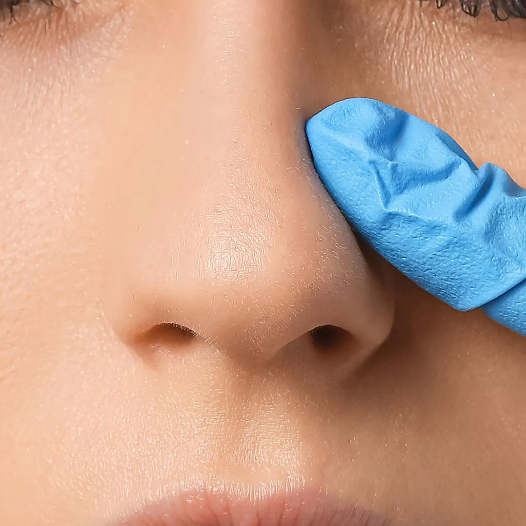 Gloved fingers beside a nose illustrating the area considered for dermal filler treatment at 23MD