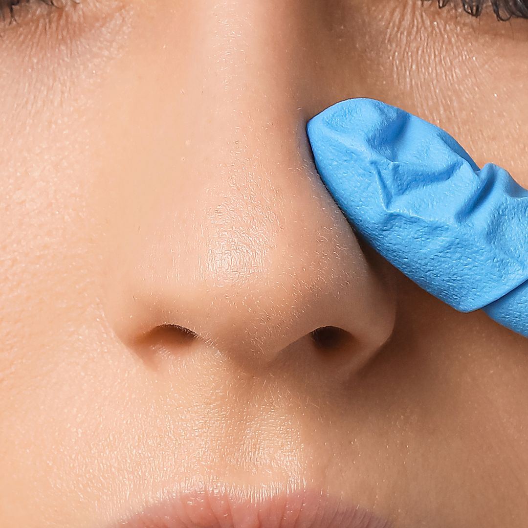 Nose Reshaping