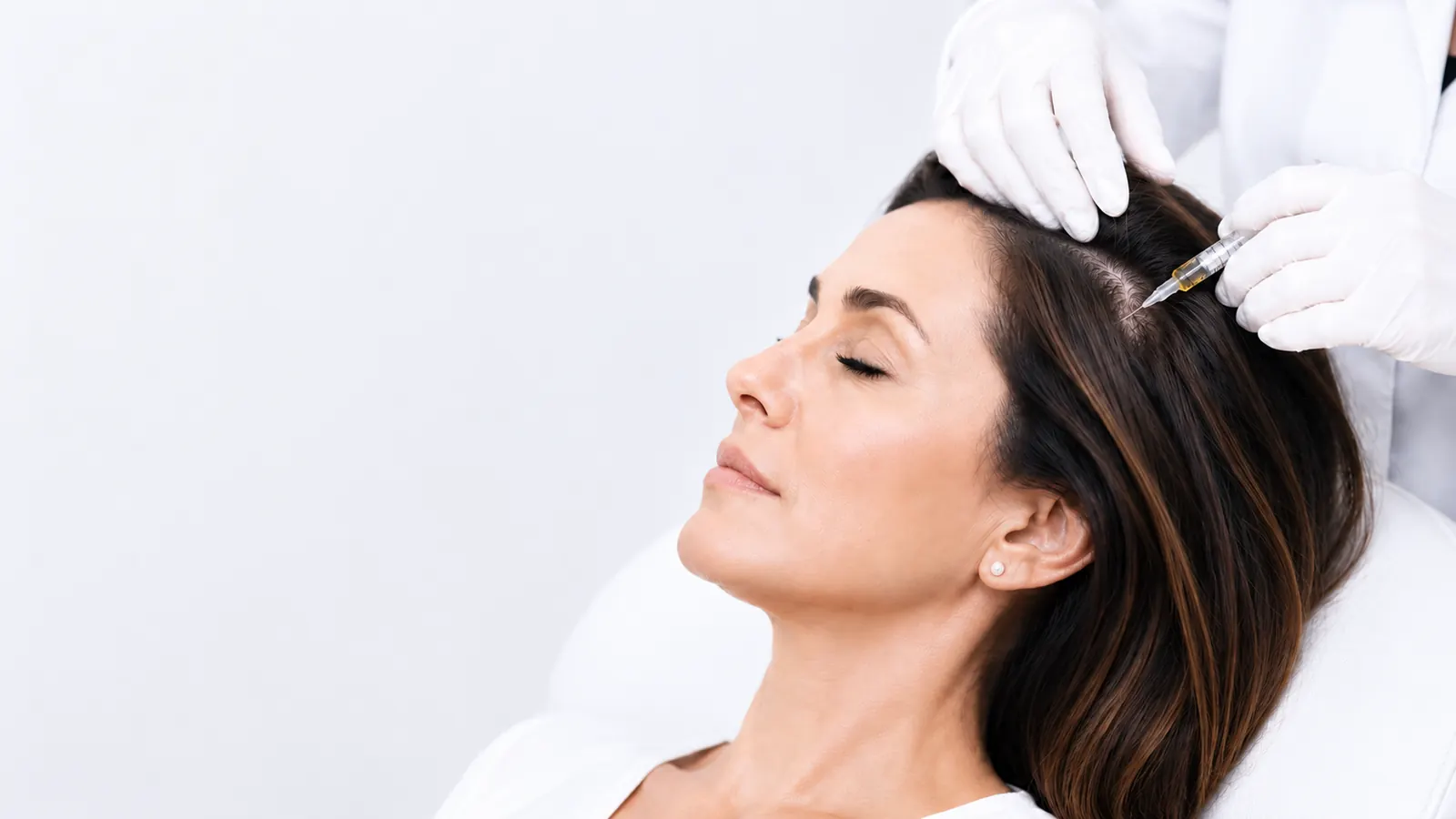 A clinician administering a polynucleotide scalp injection during hair treatment at 23MD