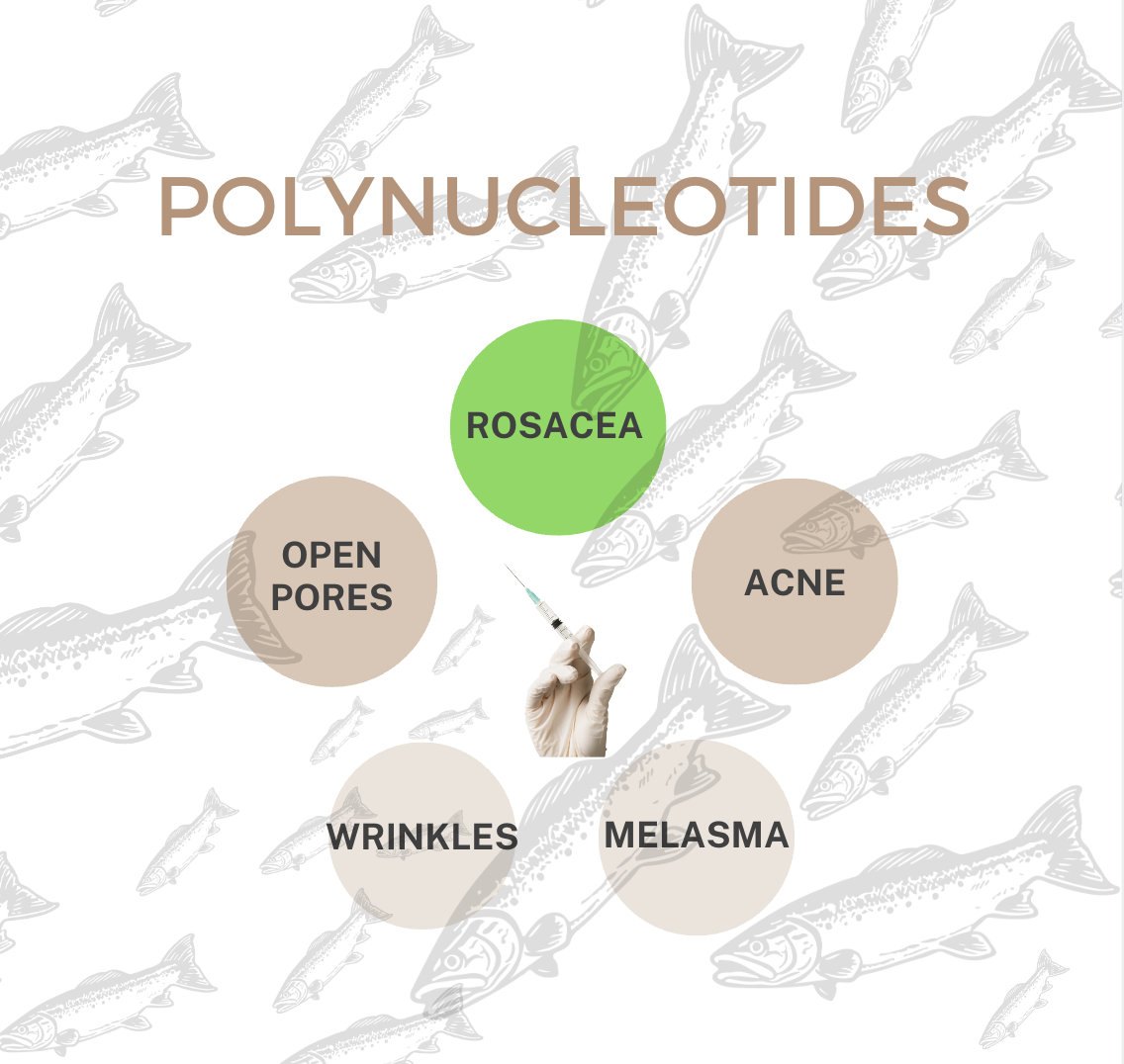 Polynucleotides Treatment for Rosacea at 23MD Clinics: A Breakthrough in Skin Care