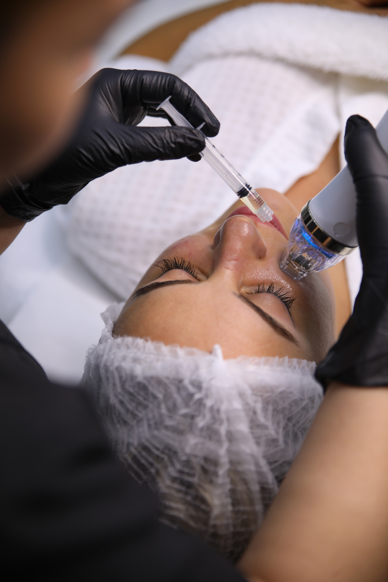 Secret RF Microneedling