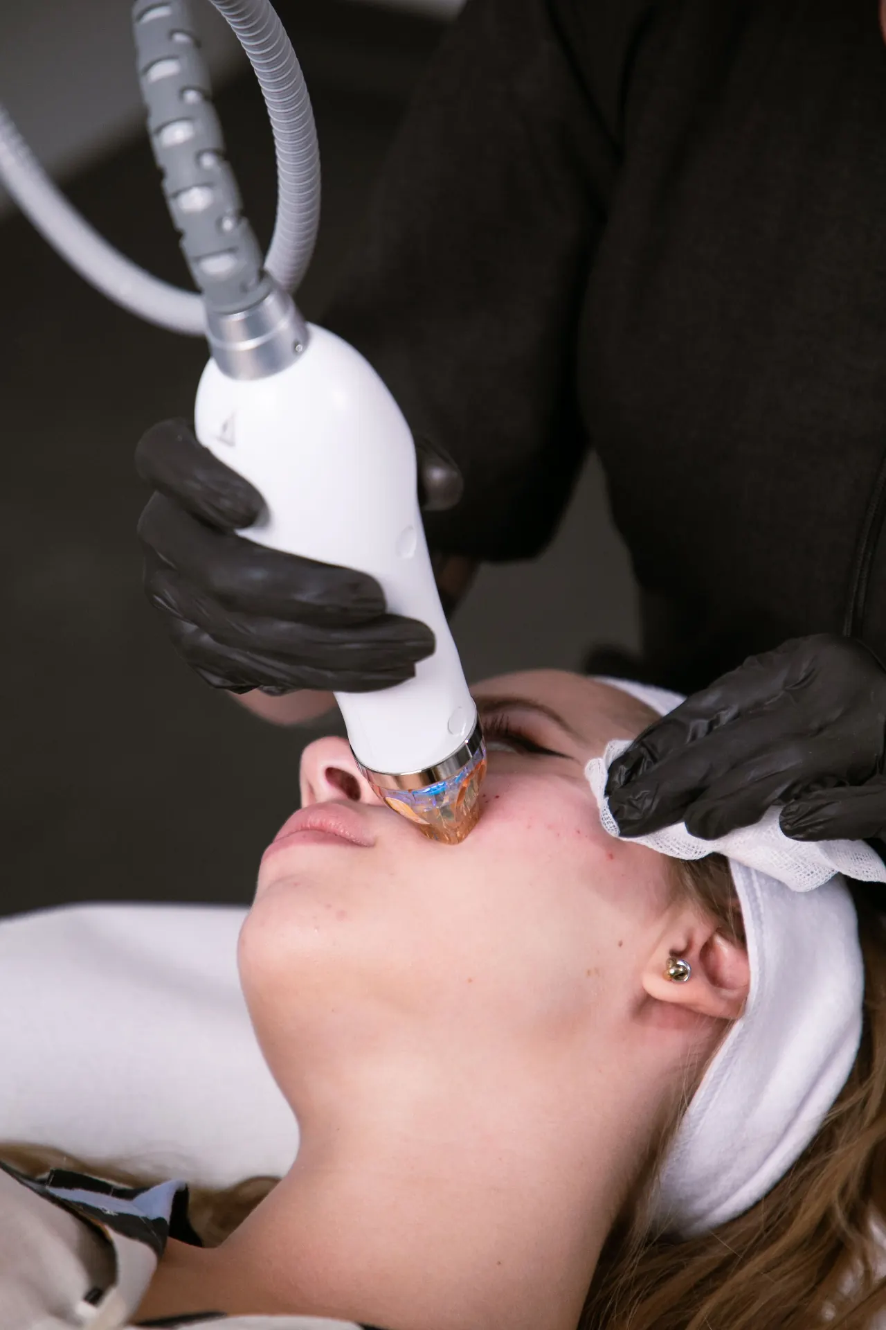 A fractional treatment applicator being applied to a patient's cheek at 23MD