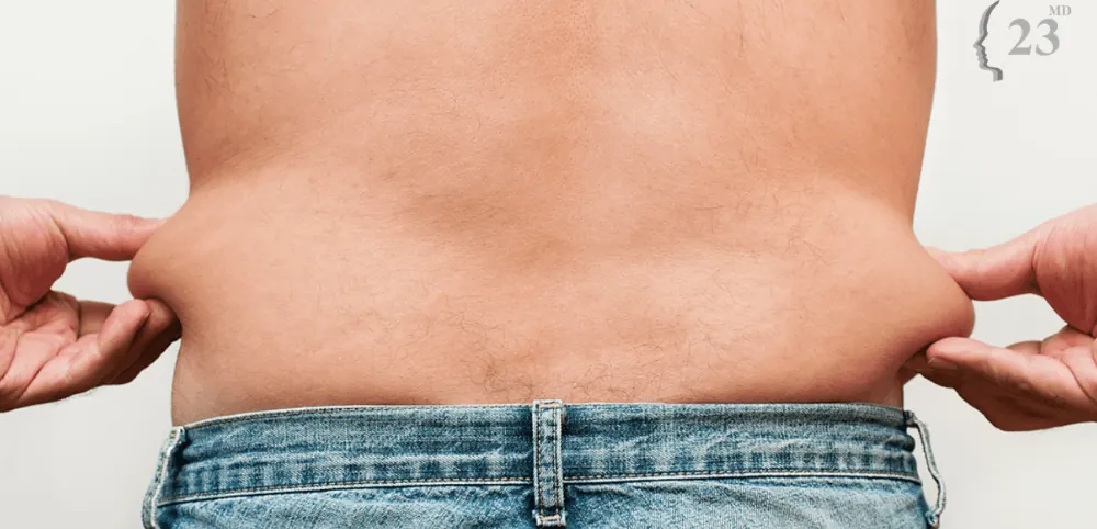 Hands pinching skin at the waist illustrating an archived health article at 23MD
