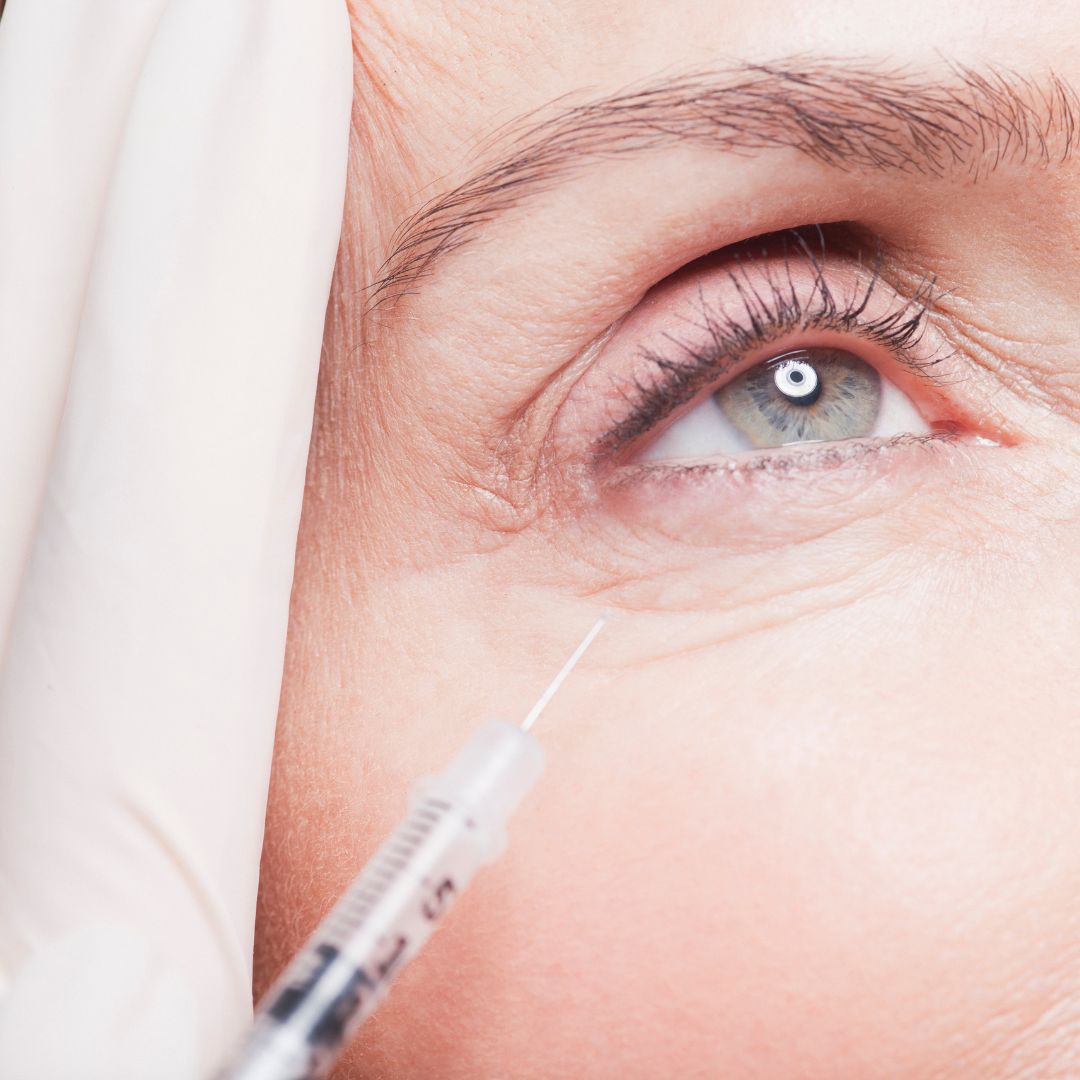 Under Eye Filler
