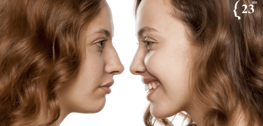 What are the benefits of non-surgical rhinoplasty?