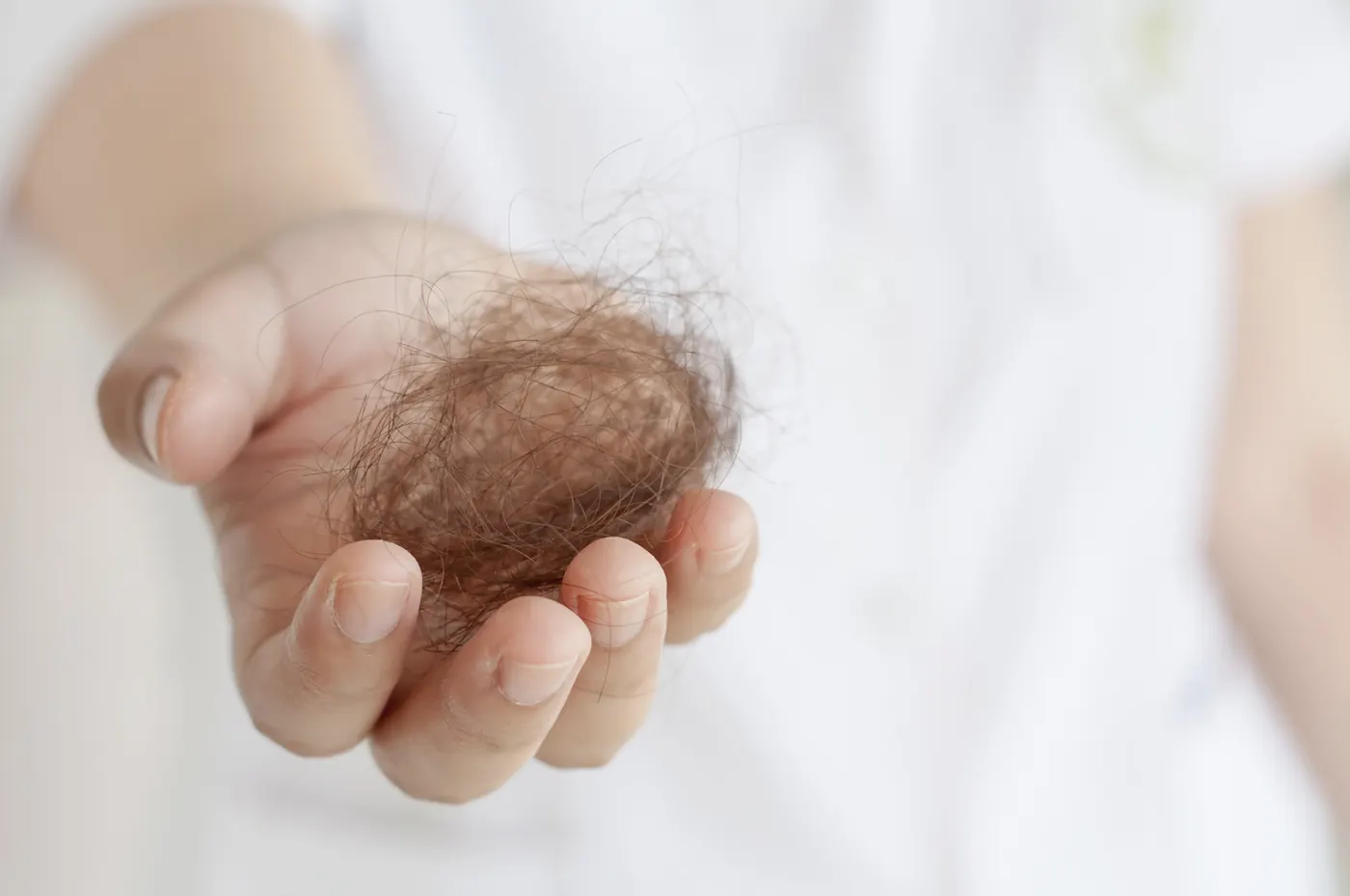 A hand holding shed hair illustrating an archived health article at 23MD