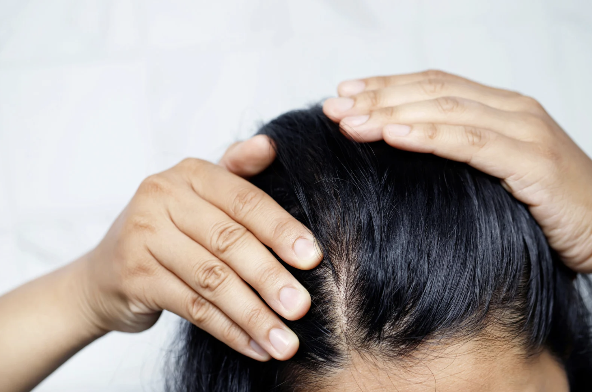 Will menopausal hair loss grow back?
